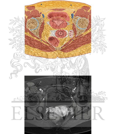 Watermarked preview of unlabeled image: Female Pelvis Axial 8