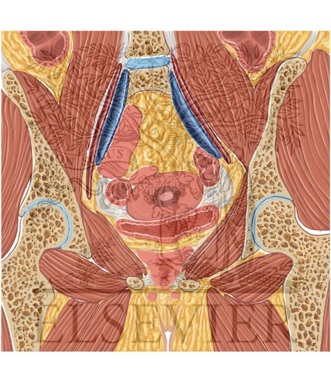 Watermarked preview of unlabeled image: Female Pelvis Coronal 5