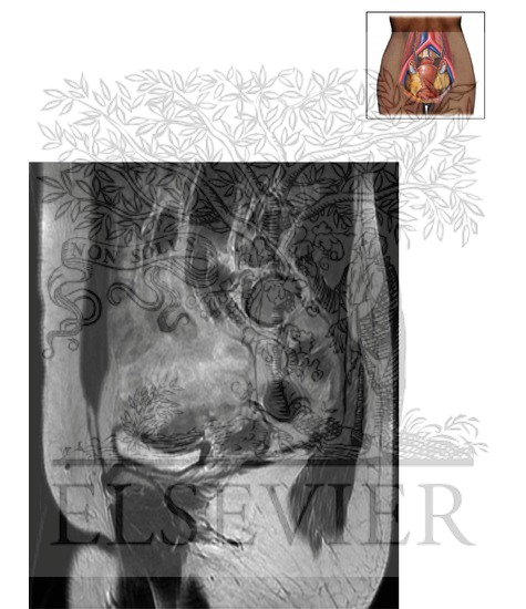 Watermarked preview of unlabeled image: Female Pelvis Sagittal 4