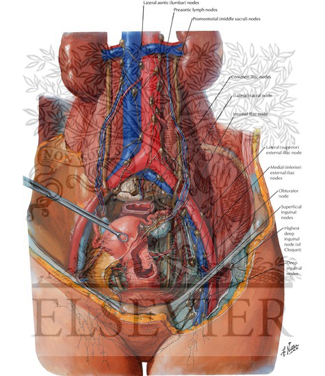 Watermarked preview of labeled image: Lymph Vessels and Nodes of Pelvis and Genitalia: Female
Lymphatic Drainage II - Internal Genitalia