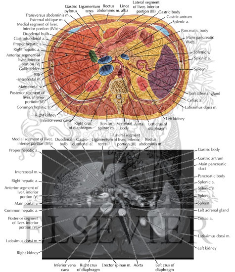 Abdomen Axial 7
