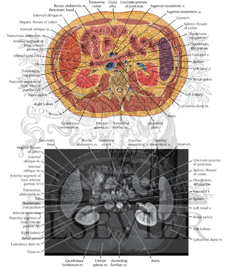 Watermarked preview of labeled image: Abdomen Axial 11