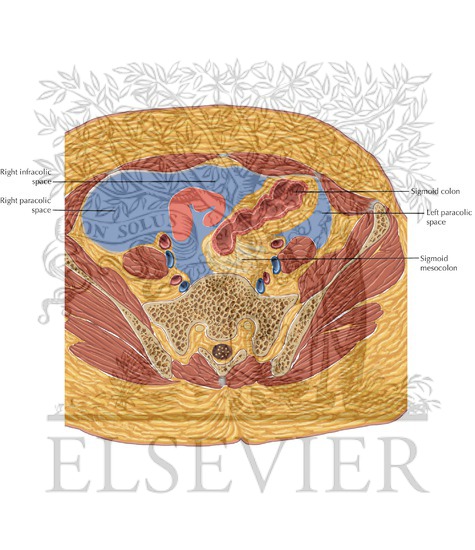 Peritoneal Cavity Pelvis Axial 1