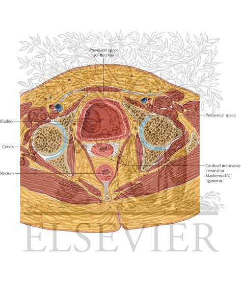 Peritoneal Cavity Pelvis Axial 8