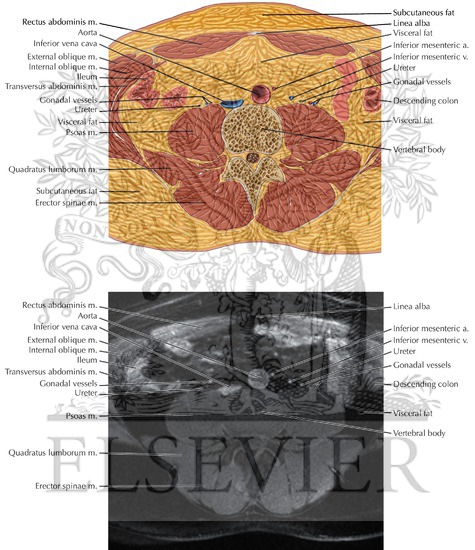 Male Pelvis Axial 1