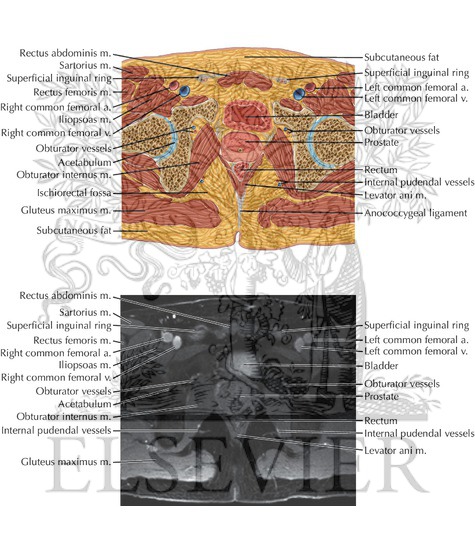 Male Pelvis Axial 12