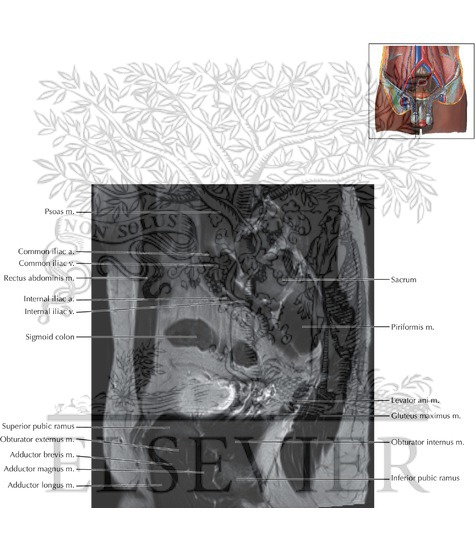 Watermarked preview of labeled image: Male Pelvis Saggittal 5