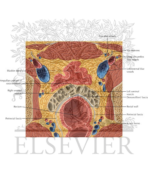 Watermarked preview of labeled image: Prostate and Seminal Tract Axial 3