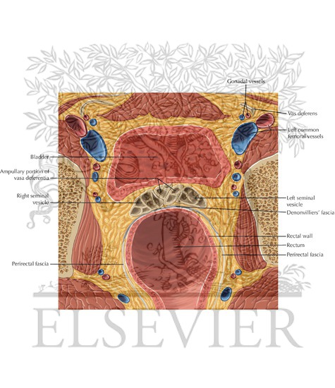 Watermarked preview of labeled image: Prostate and Seminal Tract Axial 4