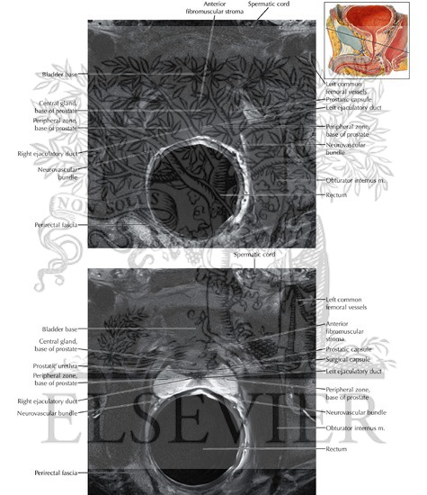 Watermarked preview of labeled image: Prostate and Seminal Tract Axial 7