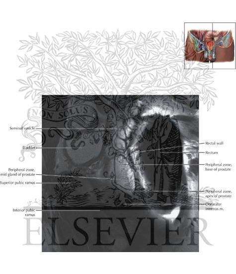 Watermarked preview of labeled image: Prostate and Seminal Tract Sagittal 1