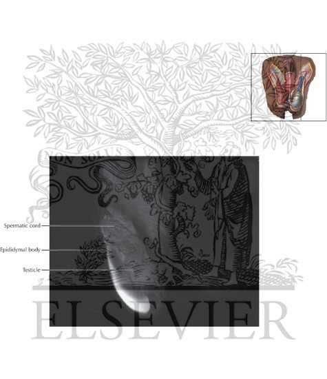 Watermarked preview of labeled image: Scrotum and Testes Sagittal 1