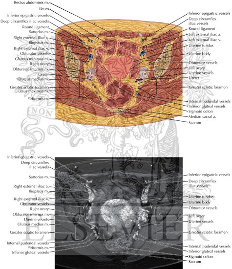 Female Pelvis Axial 5