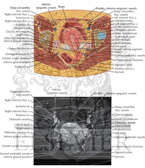 Watermarked preview of labeled image: Female Pelvis Axial 6