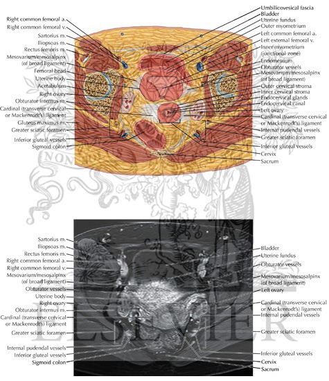 Female Pelvis Axial 7