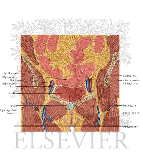 Watermarked preview of labeled image: Female Pelvis Coronal 2