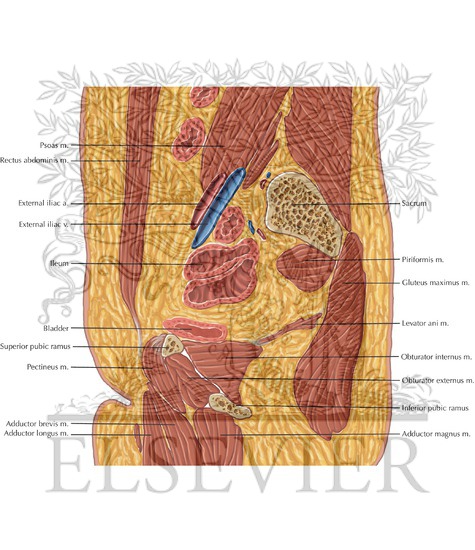 Watermarked preview of labeled image: Female Pelvis Sagittal 3