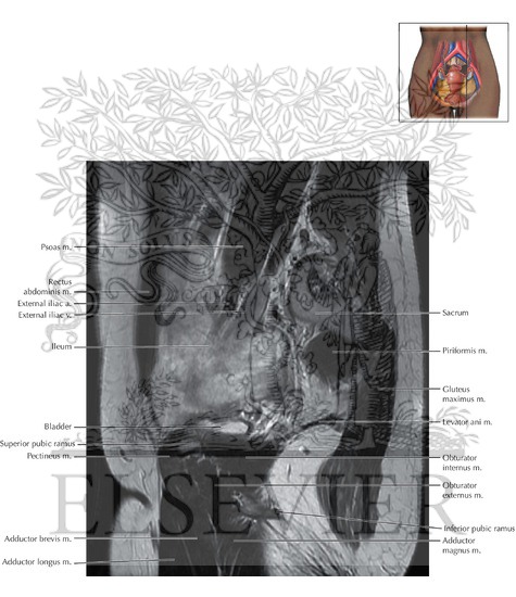 Watermarked preview of labeled image: Female Pelvis Sagittal 3