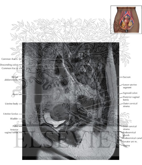 Female Pelvis Sagittal 5