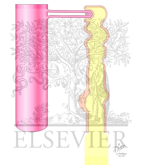 Watermarked preview of unlabeled image: Loop Diuretics