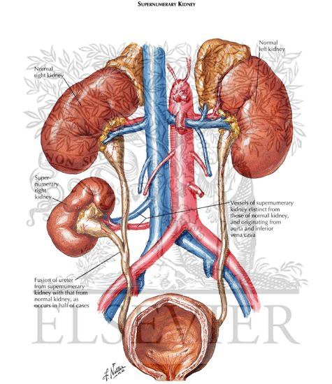 Anomalies in Number of Kidneys