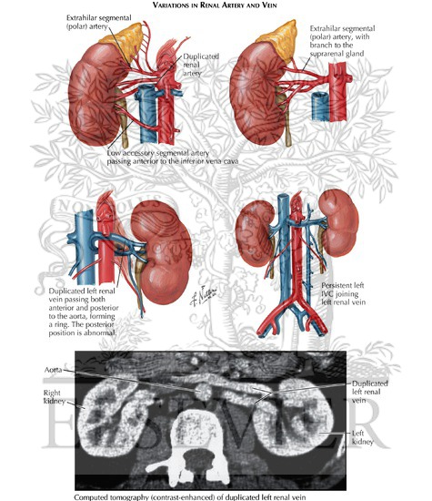 Watermarked preview of labeled image: Renal Vasculature (Continued)