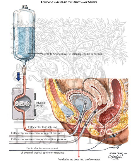 Watermarked preview of labeled image: Urodynamics Testing