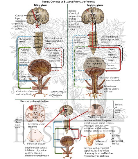 Watermarked preview of labeled image: Urodynamics: Sample Urodynamic Recordings