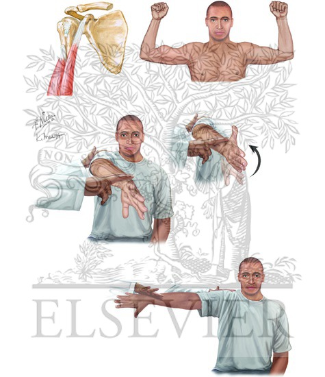Biceps, Tendon Tears, and SLAP Lesions: Presentation and Physical Examination