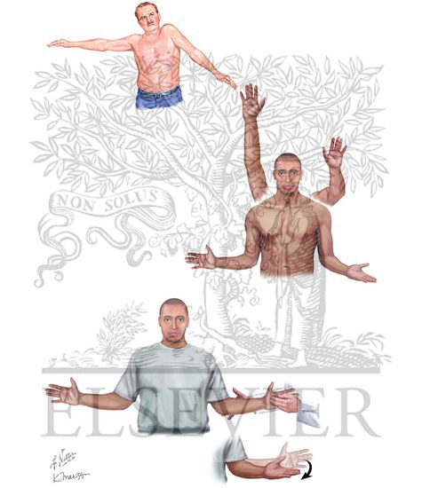 Watermarked preview of unlabeled image: Rotator Cuff Tears: Physical Examination