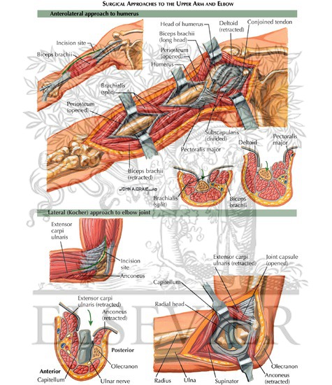 Watermarked preview of labeled image: Surgical Approaches to the Upper Arm and Elbow
