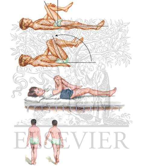 Physical Examination