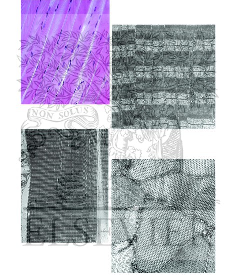 Microscopic Appearance of Skeletal Muscle Fibers