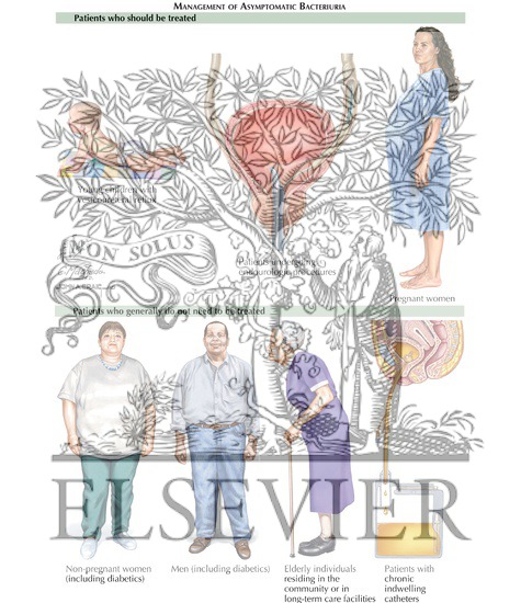 Watermarked preview of labeled image: Bacteriuria: Management of Asymptomatic Bacteriuria