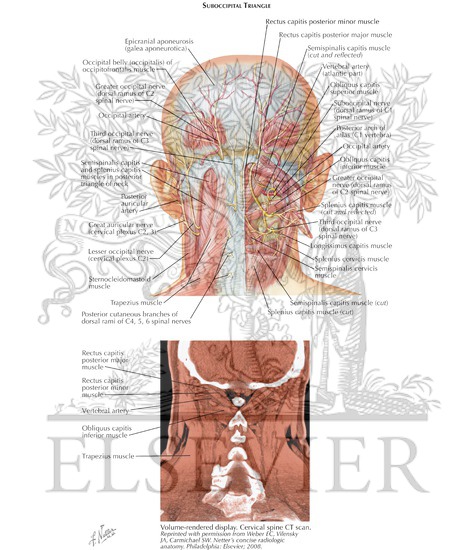 Watermarked preview of labeled image: Suboccipital Triangle