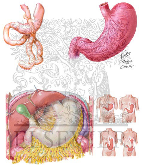 Roux-en-Y Bypass, Stomach Musculature, and Angle of His