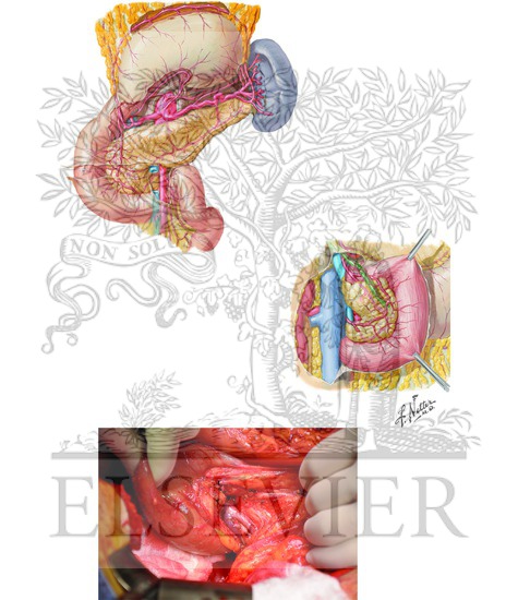 Arterial Supply of Stomach and Duodenum