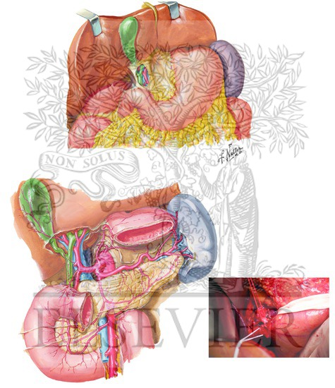Liver and Arterial Anatomy of Hepatoduodenal Ligament for Suprapancreatic Dissection