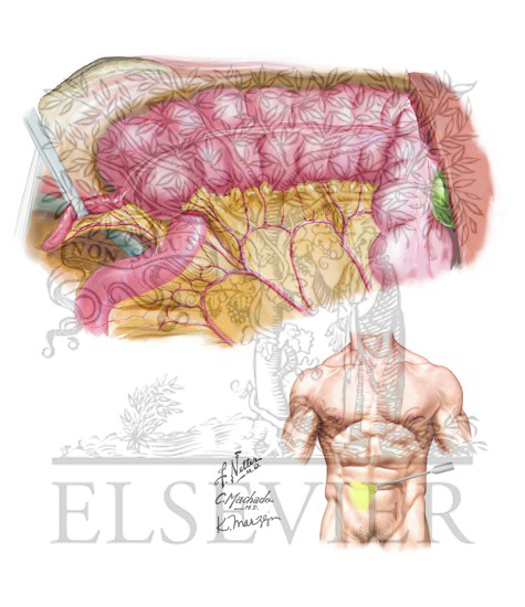 Right Lower Quadrant Anatomy Laparoscopic View