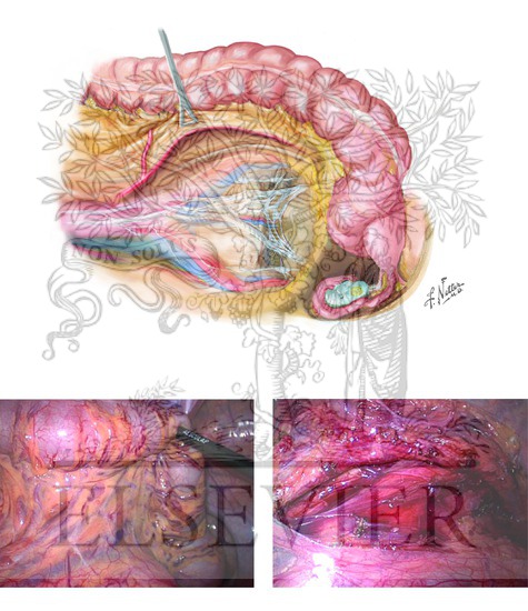 Inferior Mesenteric Artery