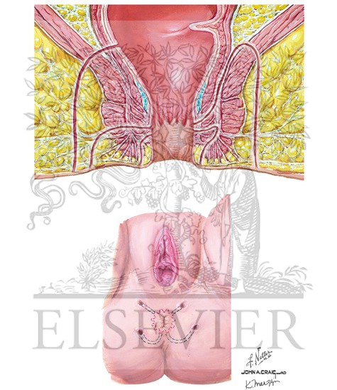 Dissertation on fistula 04 image
