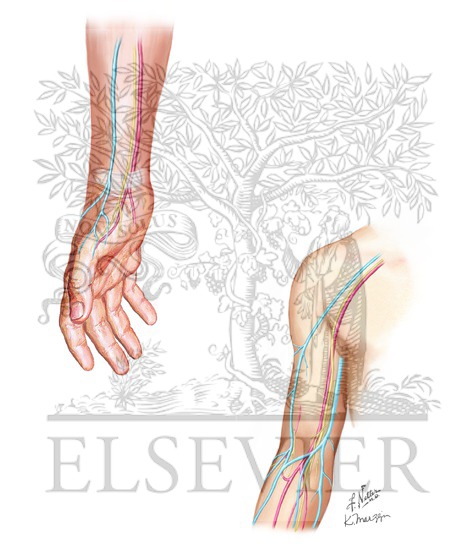 Radiocephalic, Brachiocephalic, and Brachiobasilic Arteriovenous Fistulas