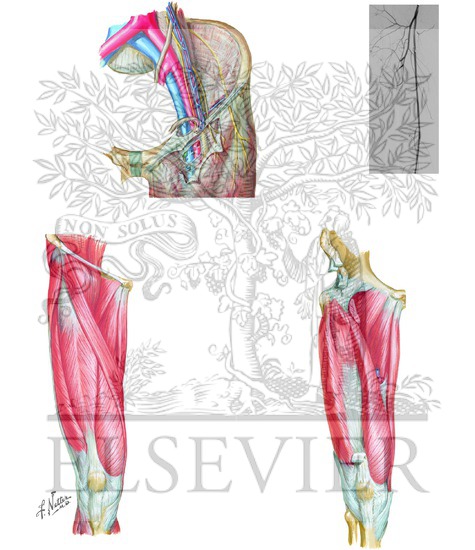 Femoral Canal and Inguinal Anatomy With Digital Subtraction Angiogram