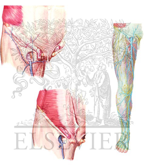 Watermarked preview of unlabeled image: Saphenofemoral Junction Exposure and Lower Limb Veins/Nerves