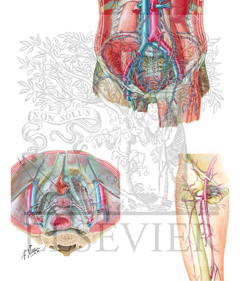 Watermarked preview of unlabeled image: Branches of External Lilac and Common Femoral Arteries; Aberrant Obturator Artery