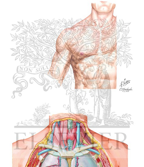 Subclavian Vein Anatomy and Insertion Sites for Catheterization