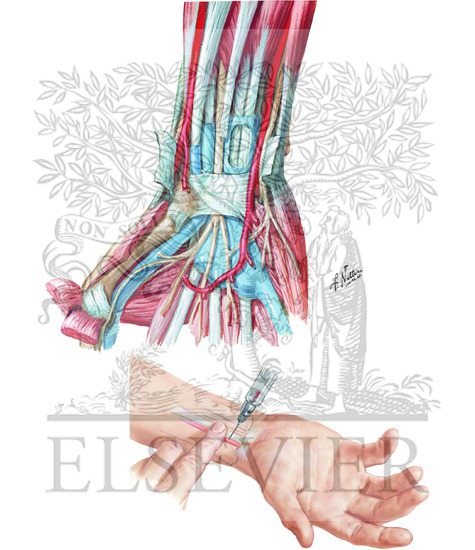 Watermarked preview of unlabeled image: Arrangement of Tendons, Vessels, and Nerves at the Wrist