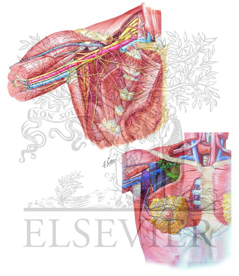 Watermarked preview of unlabeled image: Axilla (Dissection) and Lymph Vessels/Nodes of Mammary Gland