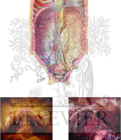 Development of Space Retzius