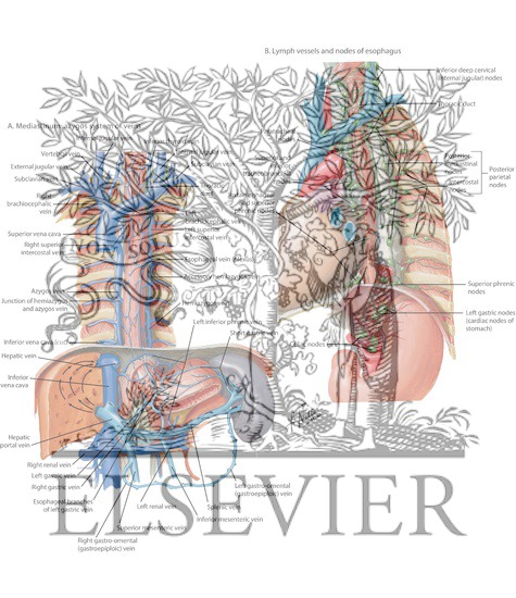 Mckeown Esophagectomy : Mckeown Or Ivor Lewis Totally Minimally Invasive Esophagectomy For Cancer Of The Esophagus And Gastroesophageal Junction Systematic Review And Meta Analysis Abstract Europe Pmc : A single incision is made from the chest to the abdomen on the left side, and an incision is made in the neck.